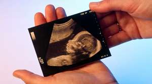 Бесплодие: диагноз и лечение Бесплодие: диагноз и лечение